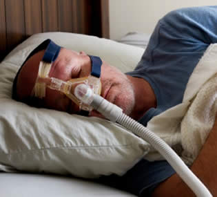 Apnea obstructiva del sueño